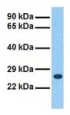 Western Blot: SCN3B Antibody [NBP3-10454]