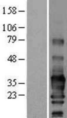 Western Blot: SCN3B Overexpression Lysate [NBL1-15743]