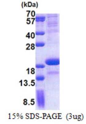 SDS-PAGE: Recombinant Human SCN3B His Protein [NBP2-22815]