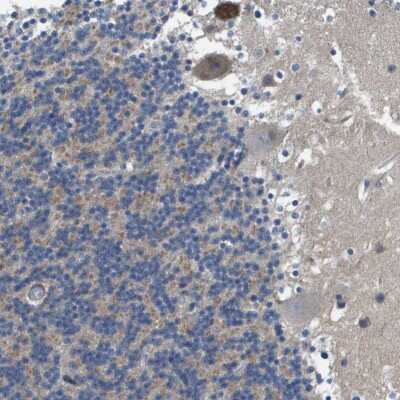 Immunohistochemistry-Paraffin: SCN4B Antibody [NBP1-86057]