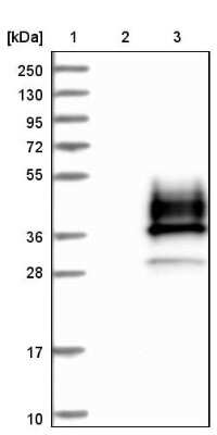 Western Blot: SCN4B Antibody [NBP1-86057]