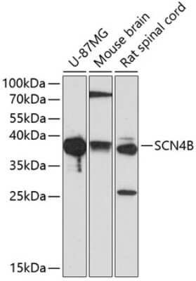 Western Blot: SCN4B AntibodyBSA Free [NBP2-93760]