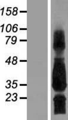 Western Blot: SCN4B Overexpression Lysate [NBP2-05056]