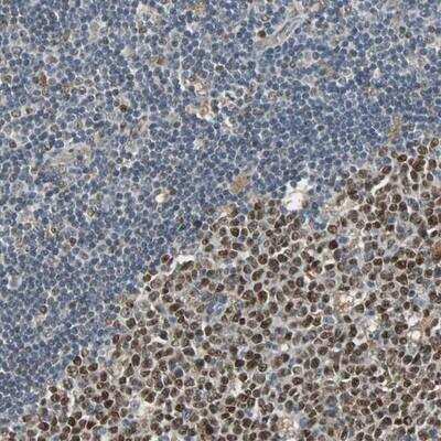 Immunohistochemistry: SCN7A Antibody [NBP1-87075]