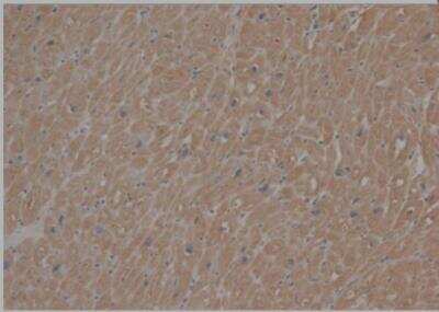 Immunohistochemistry-Paraffin: SCN7A Antibody [NB100-81029]