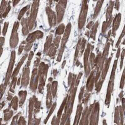 Immunohistochemistry-Paraffin: SCN7A Antibody [NBP3-17309]