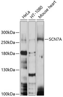 Western Blot: SCN7A AntibodyBSA Free [NBP2-94584]