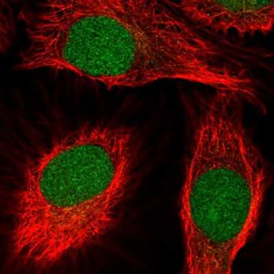 Immunocytochemistry/ Immunofluorescence: SCNM1 Antibody [NBP2-55365]