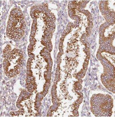 Immunohistochemistry: SCNM1 Antibody [NBP2-30728]