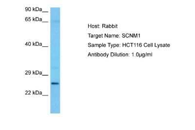 Western Blot: SCNM1 Antibody [NBP2-88223]