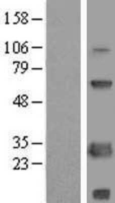 Western Blot: SCNM1 Overexpression Lysate [NBL1-15745]