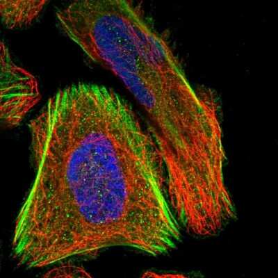 Immunocytochemistry/ Immunofluorescence: SCNN1D Antibody [NBP1-85004]