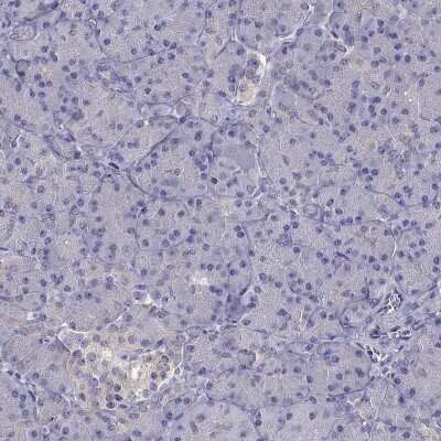 Immunohistochemistry-Paraffin: SCNN1D Antibody [NBP1-85004]