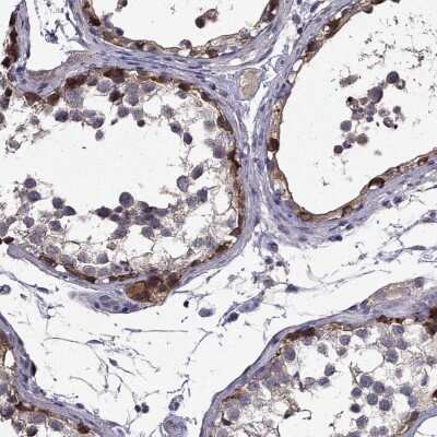 Immunohistochemistry-Paraffin: SCNN1D Antibody [NBP1-85004]