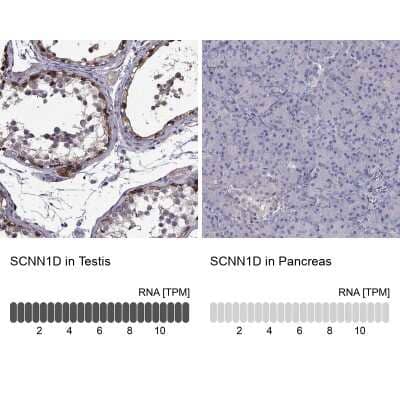 Immunohistochemistry-Paraffin: SCNN1D Antibody [NBP1-85004]