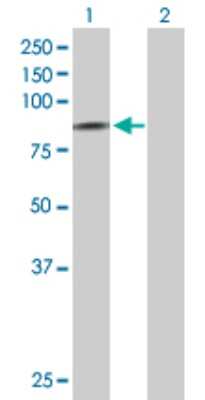 Western Blot: SCNN1D Antibody [H00006339-D01P]