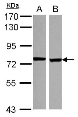 Western Blot: SCNN1D Antibody [NBP2-20271]