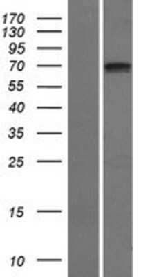 Western Blot: SCNN1D Overexpression Lysate [NBP2-08053]