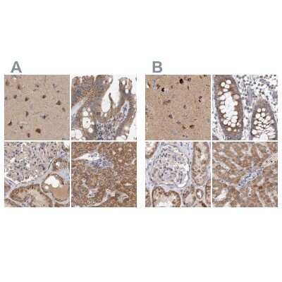 Immunohistochemistry-Paraffin: SCO1 Antibody [NBP1-87073]