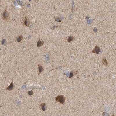 Immunohistochemistry-Paraffin: SCO1 Antibody [NBP1-87073]