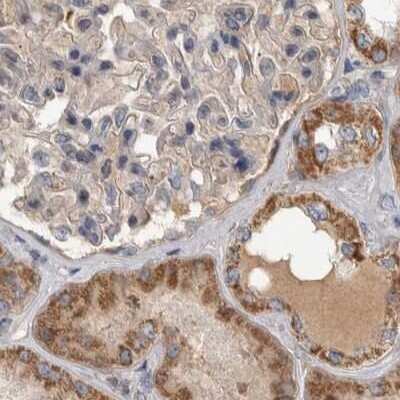 Immunohistochemistry-Paraffin: SCO1 Antibody [NBP1-87073]