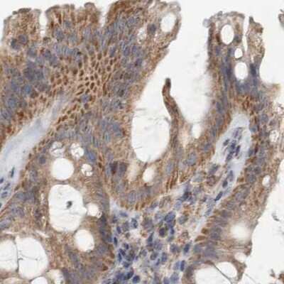 Immunohistochemistry-Paraffin: SCO1 Antibody [NBP1-87073]