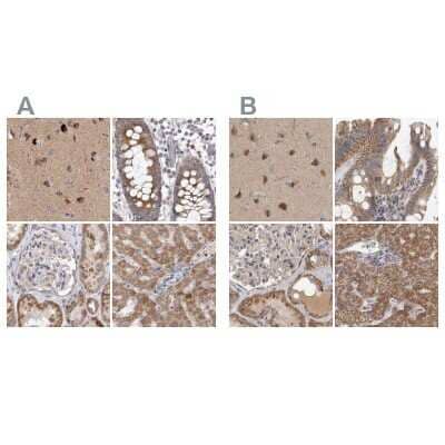 Immunohistochemistry-Paraffin: SCO1 Antibody [NBP1-87074]
