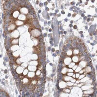 Immunohistochemistry-Paraffin: SCO1 Antibody [NBP1-87074]