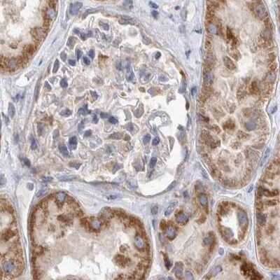 Immunohistochemistry-Paraffin: SCO1 Antibody [NBP1-87074]