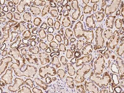 Immunohistochemistry-Paraffin: SCO1 Antibody [NBP2-97289]