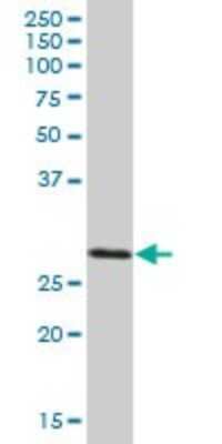 Western Blot: SCO1 Antibody [H00006341-B01P]