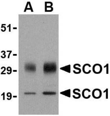 Western Blot: SCO1 AntibodyBSA Free [NBP1-77273]