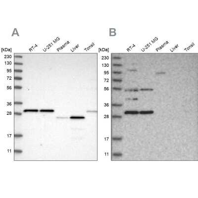 Western Blot: SCO1 Antibody [NBP1-87073]