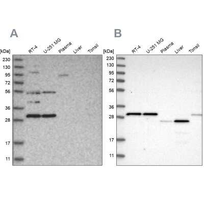 Western Blot: SCO1 Antibody [NBP1-87074]