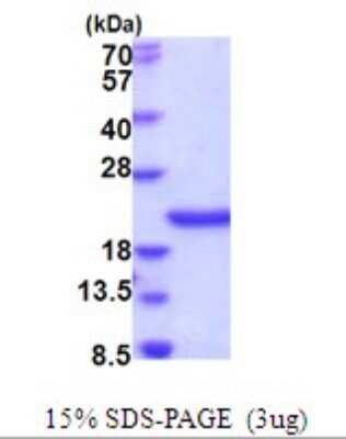 SDS-PAGE: Recombinant Human SCO1 His Protein [NBP2-51935]