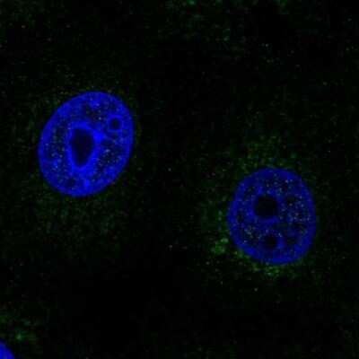 Immunocytochemistry/ Immunofluorescence: SCO2 Antibody [NBP2-68675]