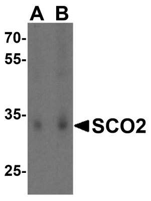 Western Blot: SCO2 AntibodyBSA Free [NBP1-77274]