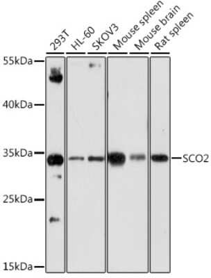 Western Blot: SCO2 AntibodyAzide and BSA Free [NBP2-94525]