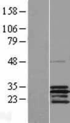 Western Blot: SCO2 Overexpression Lysate [NBP2-07787]