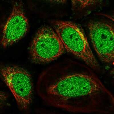 Immunocytochemistry/ Immunofluorescence: SCOC Antibody [NBP2-56829]