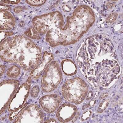 Immunohistochemistry-Paraffin: SCOC Antibody [NBP2-49630]