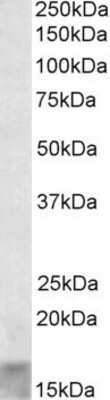 Western Blot: SCOC Antibody [NBP1-72058]