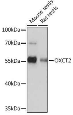 Western Blot: SCOT2 AntibodyAzide and BSA Free [NBP2-93673]