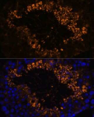 Immunohistochemistry: SCOT2 Antibody - Azide and BSA Free [NBP2-93673]