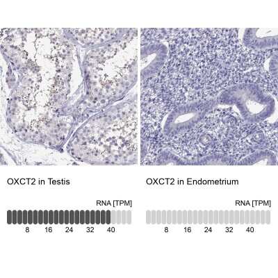 Immunohistochemistry-Paraffin: SCOT2 Antibody [NBP2-62696]