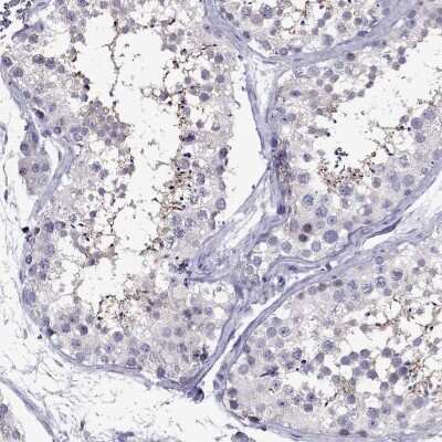 Immunohistochemistry-Paraffin: SCOT2 Antibody [NBP2-62696]