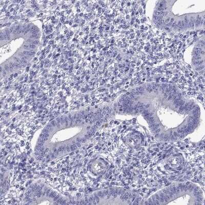 Immunohistochemistry-Paraffin: SCOT2 Antibody [NBP2-62696]