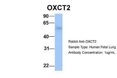 Western Blot: SCOT2 Antibody [NBP1-57929]