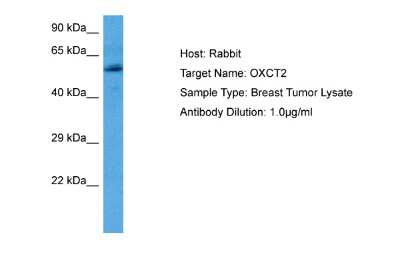 Western Blot: SCOT2 Antibody [NBP2-88224]