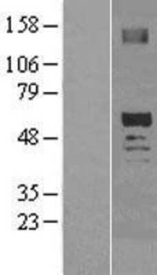 Western Blot: SCOT2 Overexpression Lysate [NBL1-14019]